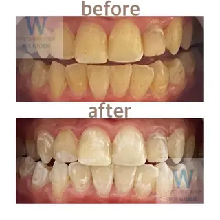 メンズ ホワイトニング ショップ本八幡店のエステ・リラクイメージ