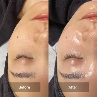 本気の小顔×毛穴ケア ／もりやま はるかのエステ・リラクイメージ