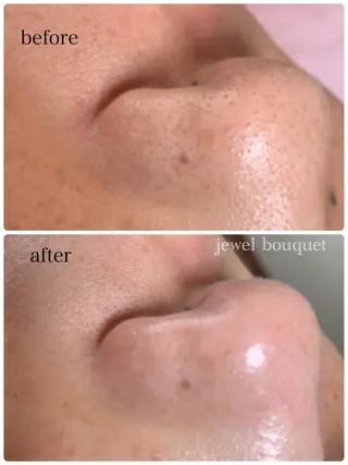 美BODY美FACEサロンjewelbouquet所属・jewel bouquetのエステ・リラクイメージ