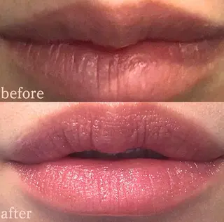 小顔/たるみ/黒ずみ除去専門サロン/SONA 大和西大寺店所属・【小顔専門看護師 サロンSONA】のエステ・リラクイメージ