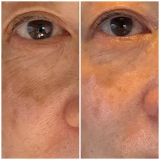 自宅salon🌿 kukunaのエステ・リラクイメージ