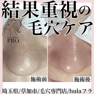 毛穴専門店hula 杉山智美のエステ・リラクイメージ