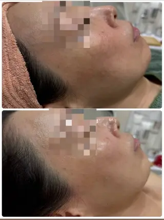 美肌脱毛サロン muroのエステ・リラクイメージ