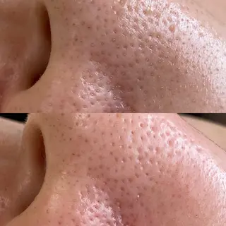 はり灸サロン totonoi所属・印象の良くなる 美容鍼のエステ・リラクイメージ