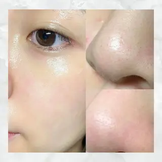 マツエク・マツパ 愛維美水光美肌専門店所属・愛維美水光美肌専門店 メンズレディースokのエステ・リラクイメージ