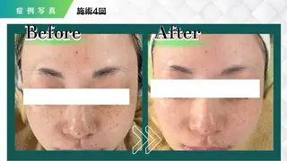 CHARMER韓国式美肌サロン所属・CHARMER🌹 Naokoのマツエク・マツパデザイン