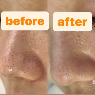 都度払い肌改善専門店 店長二上文香のエステ・リラクイメージ