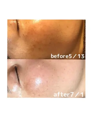 浜野 恵美のエステ・リラクイメージ