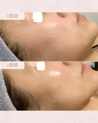 MAUM-美 caresalon-のエステ・リラクイメージ