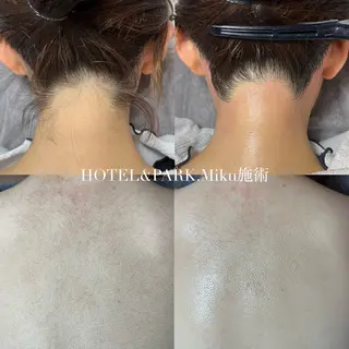HOTEL&PARK Mikuワックス脱毛のエステ・リラクイメージ