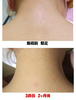 Salon Ree Belle(サロン リベル)所属・サロン リベル YUKAのエステ・リラクイメージ