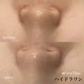 omii salon 草津店:yurinaのマツエク・マツパデザイン