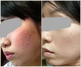 リラク&エステViola所属・阿部 まなのエステ・リラクイメージ