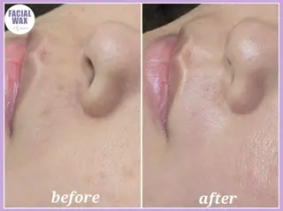 facial salon Lily所属・salon Lilyのエステ・リラクイメージ