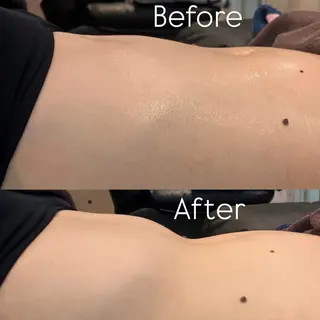 Joo🌿肌育/高岳 アトピー/肌質改善のエステ・リラクイメージ