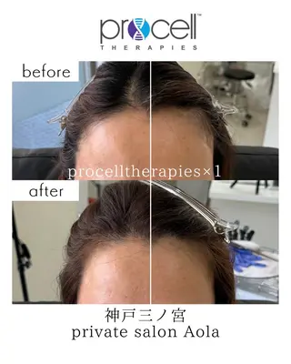 private salon Aola所属・プライベートサロン アオラのネイルデザイン