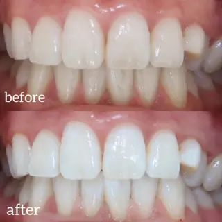 Luv the TERRACEのその他イメージ