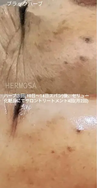 オールハンド フェイシャルのエステ・リラクイメージ