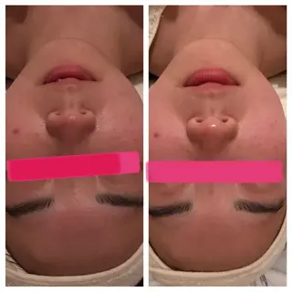 POLA大阪堀江店所属・POLA大阪堀江店 小顔エステのエステ・リラクイメージ