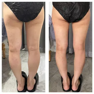 部分痩せ♥️小顔専門 MIKUのエステ・リラクイメージ