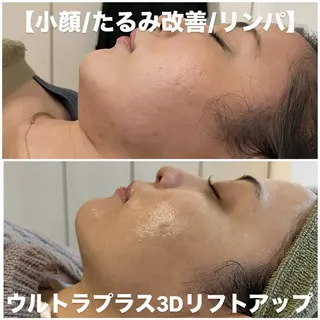 ビューティーサロン リノアのエステ・リラクイメージ