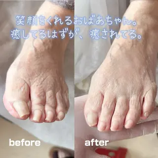巻き爪フットケアサロンKotori所属・フットケアサロン Kotoriのその他イメージ