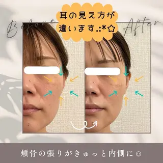 小顔セラピーLIL所属・小顔セラピー LILのエステ・リラクイメージ