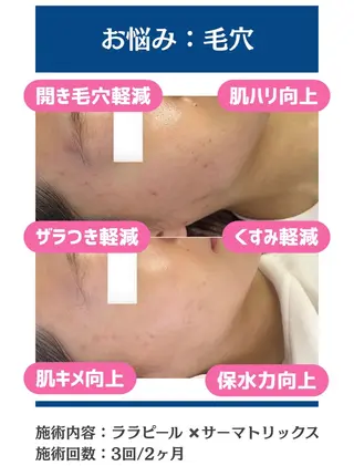 毛穴レス美肌へ🌿 看護師Abe🌼のエステ・リラクイメージ