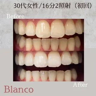 Blanco川口駅前店所属・Blanco 川口駅前店のその他イメージ