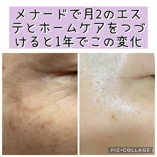 メナードフェイシャル サロンmakiのエステ・リラクイメージ