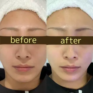 Lumus Solarum所属・Lumus Solarumのエステ・リラクイメージ