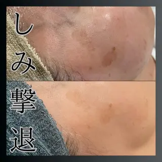 LiZA エステティックサロンのその他イメージ