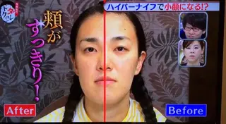 ワックス脱毛 ♡AYO♡のエステ・リラクイメージ