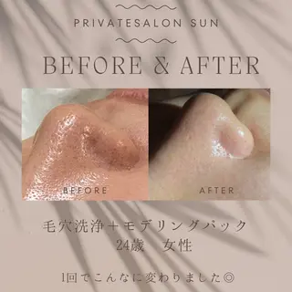 肌質改善サロン🌻 Nico laughのエステ・リラクイメージ