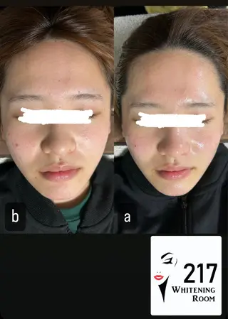 217whitening  room所属・217 ホワイトニングルームのエステ・リラクイメージ