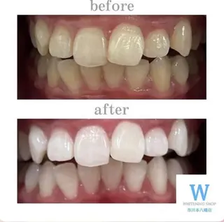 ホワイトニング ショップ本八幡店のエステ・リラクイメージ