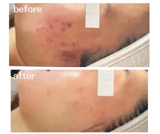 aimee　肌質改善サロン【アイミー】所属・肌質改善サロン aimee｜アイミーのエステ・リラクイメージ