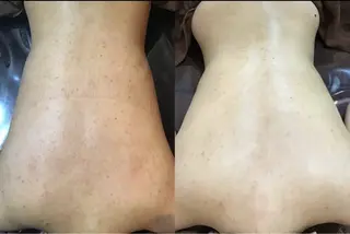 エレファンテブランコ所属・エレファンテブランコ yukariのエステ・リラクイメージ