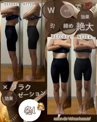 ヴィーナス ビューティーのエステ・リラクイメージ