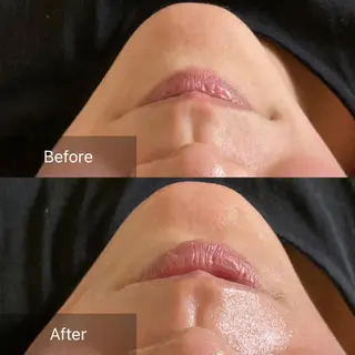 産毛専門店 Bittoのエステ・リラクイメージ