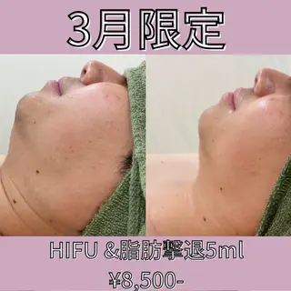 次世代痩身 人生最後のダイエットのエステ・リラクイメージ