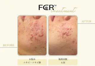 ララピール銀座 小顔フェイシャルのエステ・リラクイメージ