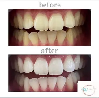 ホワイトニング ショップ本厚木のその他イメージ