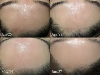 lymph care 'Welnəsのエステ・リラクイメージ