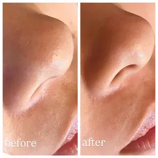 肌質改善専門 ハーブ /毛穴洗浄 リエイトのエステ・リラクイメージ