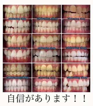 ホワイトニング ショップ吉祥寺店のエステ・リラクイメージ