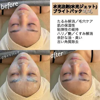 うなじ脱毛/美肌脱毛 LABELのエステ・リラクイメージ