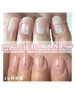 ネイル 自爪育成nail fachuriのネイルデザイン