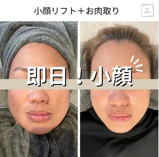 salon de perfectionのエステ・リラクイメージ