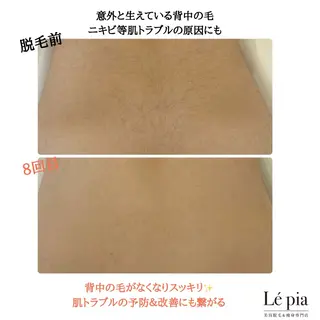 美容脱毛専門店 Lé pia レピアのエステ・リラクイメージ